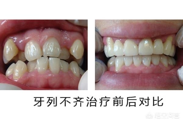 怒江最新24小时牙医在线咨询方法分析(最方便真实的怒江有没有24小时牙医方法)
