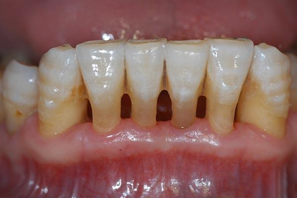 怒江最新24小时牙医在线咨询方法分析(最方便真实的怒江有没有24小时牙医方法)